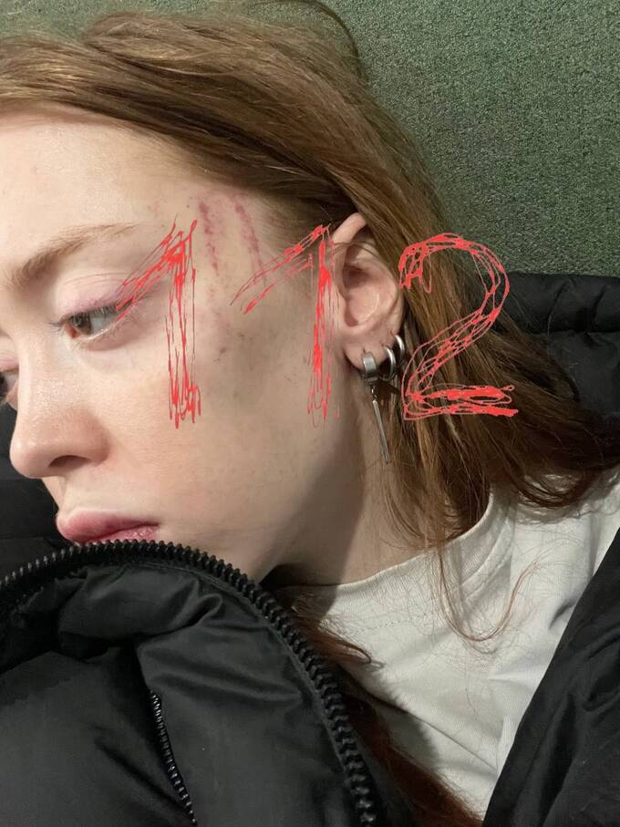  tidttiqzqiqkdvls qhxidiqxkiqekrps